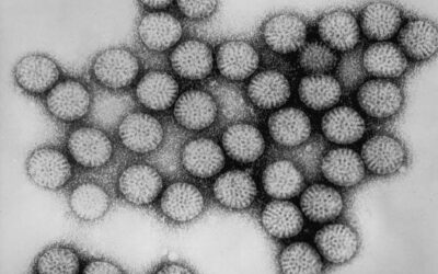 When the stomach bug makes you anxious